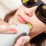 باور‌های غلط در مورد لیزر موهای زائد