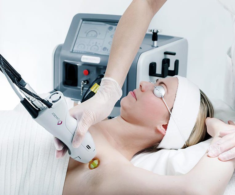 لیزر بدون بازگشت در اصفهان